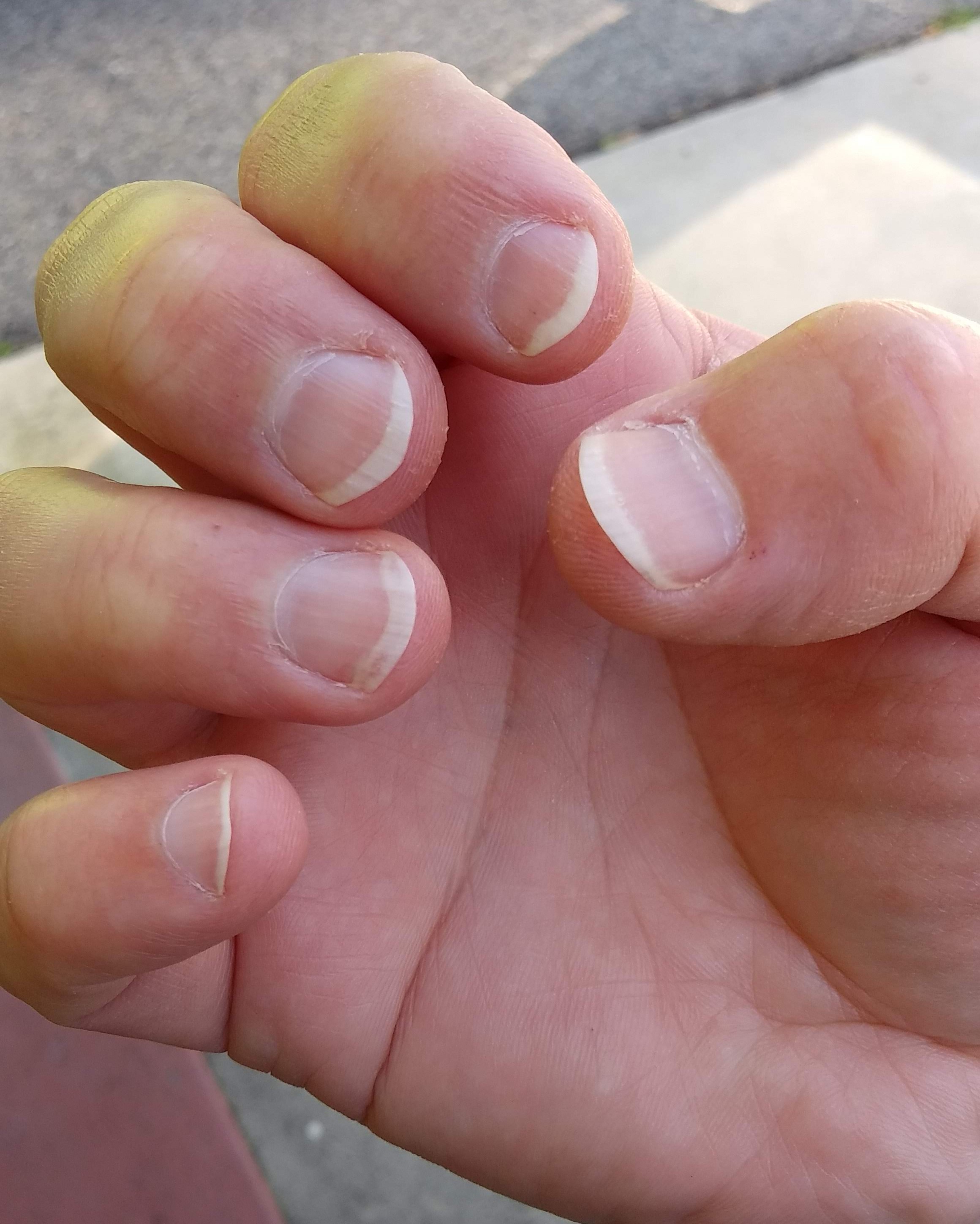 The fingernails on my right hand for playing the classical guitar